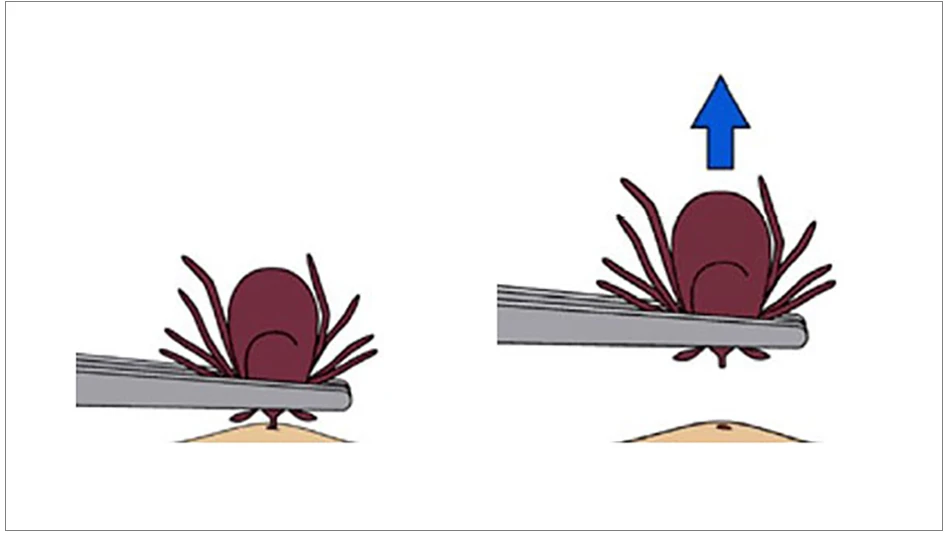 Image courtesy of CDC.gov